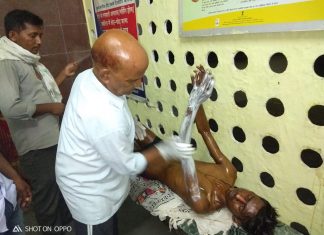 पिपरमिंट की पेराई के दौरान हुआ ब्लास्ट,काम कर रहा युवक झुलसा