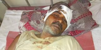 दबंग पिता पुत्र ने युवक के आंखों में मिर्च झोंककर किया जानलेवा हमला