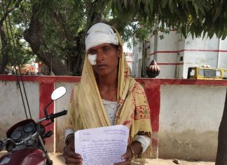शराब के लिए पैसे ना देने पर युवक ने पत्नी पर किया कुल्हाड़ी से हमला