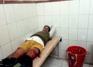 स्कूटी सवार युवकों को गाड़ी की लगी तेज रोशनी से स्कूटी सवार हुआ अनियंत्रित,स्कूटी सवार युवक हुए गम्भीर रूप से घायल